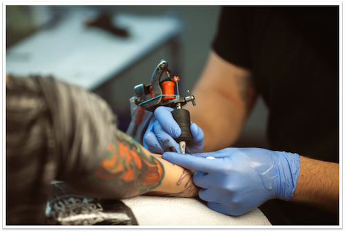 Tattoo Removal After Care